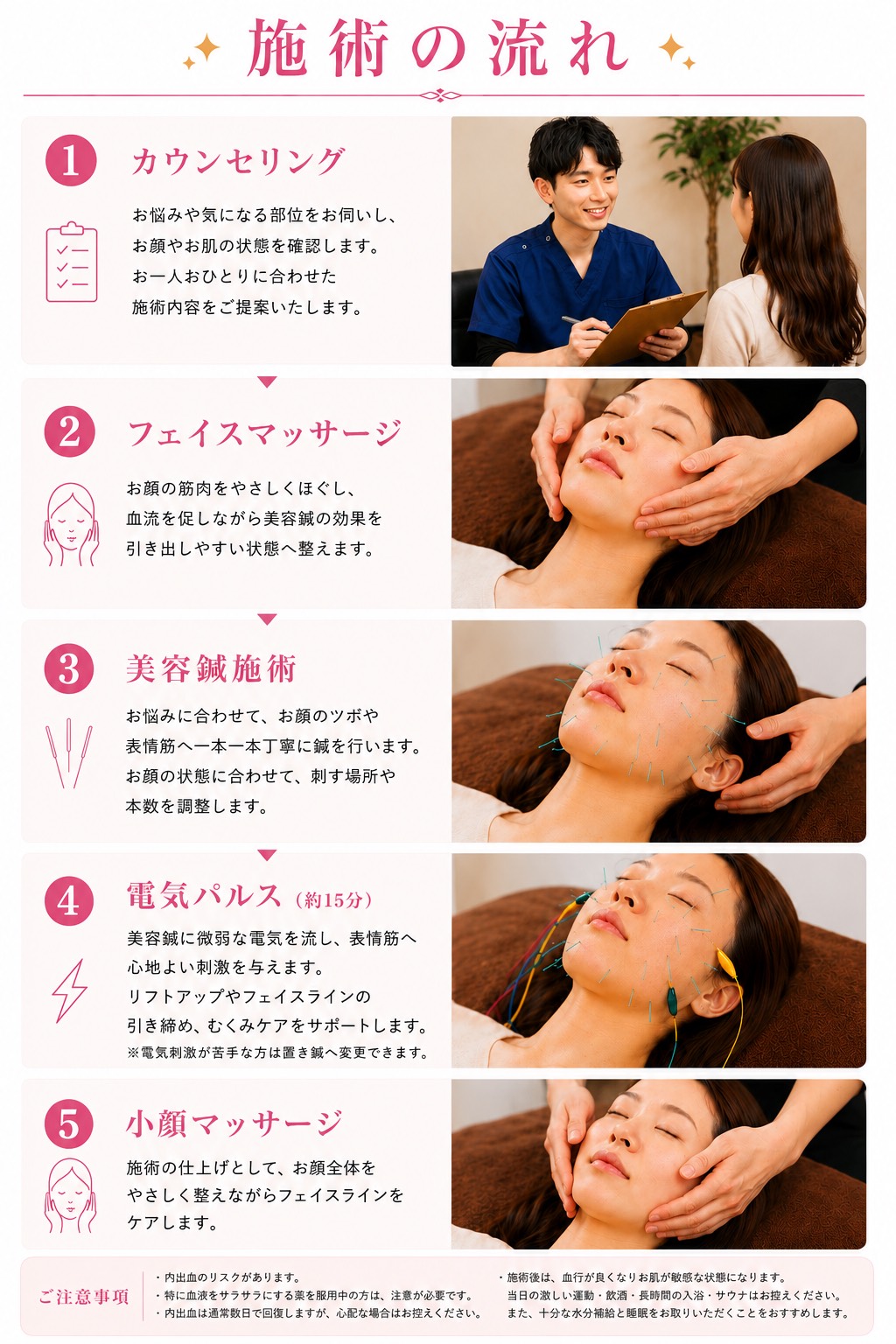 電気パルス×幹細胞美顔鍼施術の流れ①カウンセリング②フェイスマッサージ③美容鍼④電気パルス（約15分）⑤小顔マッサージ